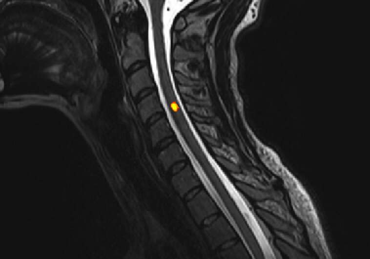 Restless nature of human spinal cord revealed by non-invasive functional imaging