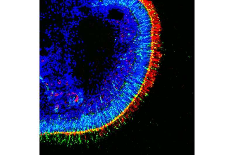 Scientists create functional human retinas in a dish