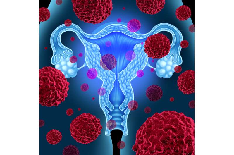 Cervical cancer: new radiotherapy technique prolongs survival