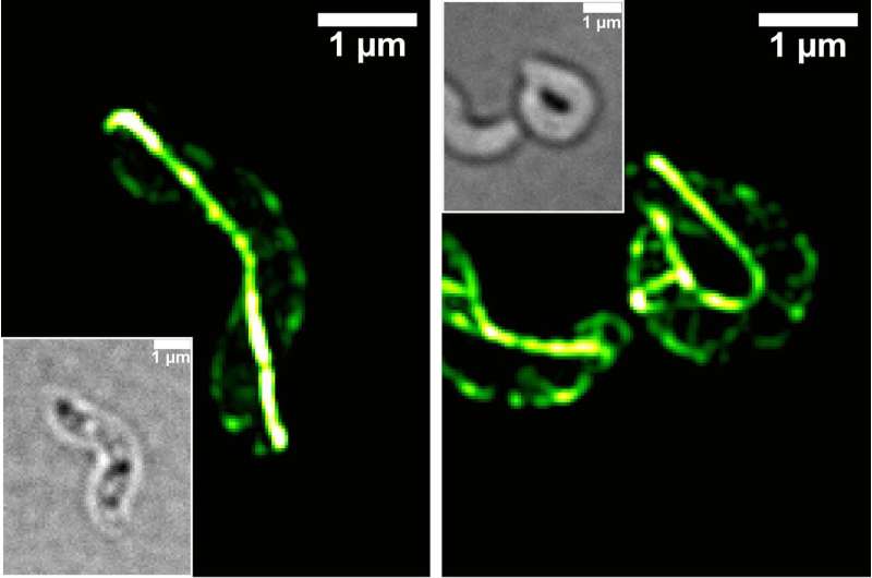 Microbiologists discover key protein for controlling cell shape in magnetic bacteria