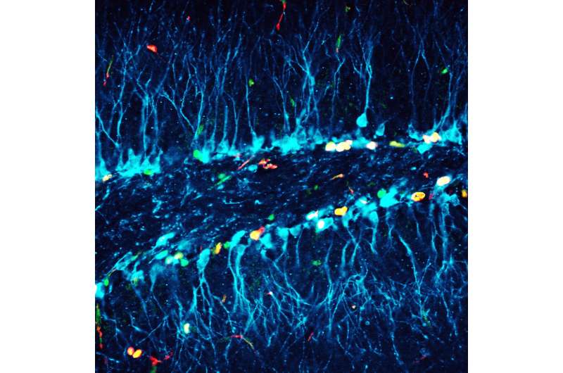 Free radicals seem to be good for the brain—new insights into the mechanisms of neuroplasticity