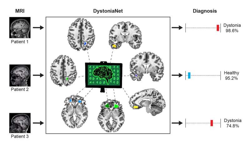 Artificial intelligence platform diagnoses dystonia with high accuracy in 0.36 seconds