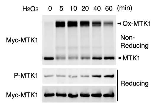 Identification of new 'oxidative stress sensor' MTK1