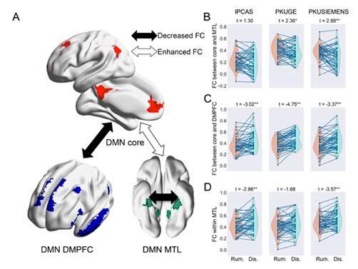 Researchers uncover network mechanism underlying rumination