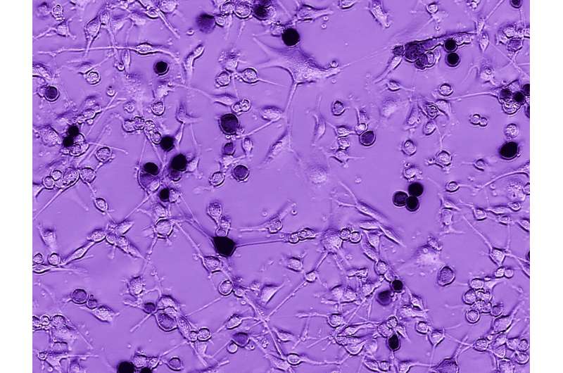 科学家发现对抗脑瘤的盟友:埃博拉病毒