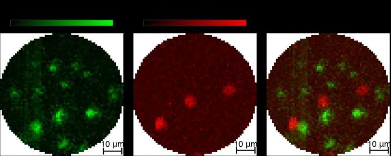 Researchers combine photoacoustic and fluorescence imaging in tiny package