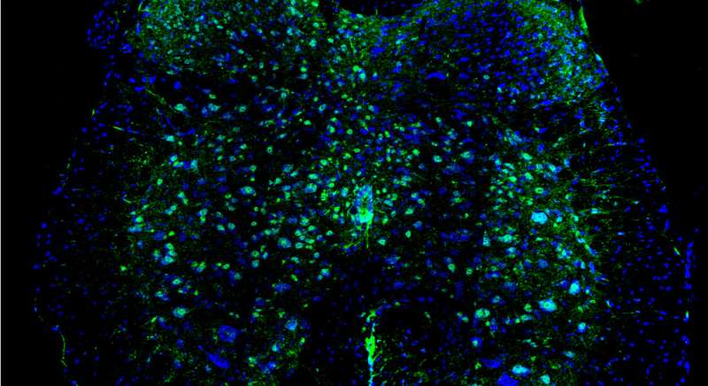 Researchers discover treatment for spasticity in mice, following spinal cord injuries