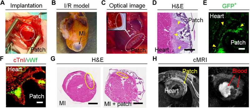 Four-dimensional physiologically adaptive cardiac patch