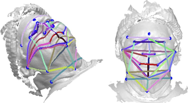 Study suggests 3D face photos could be a sleep apnea screening tool