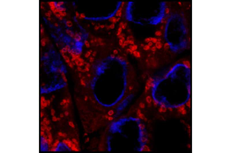 Researchers discover a key to the survival of dormant breast cancer cells