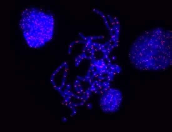 Researchers uncover the unique way stem cells protect their chromosome ends