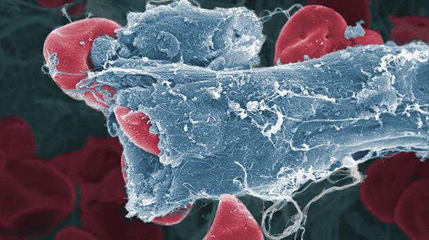 New treatment for rare blood cancer approved for NHS use in England