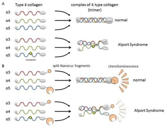 Alport syndrome severity can be predicted by causative protein genotype