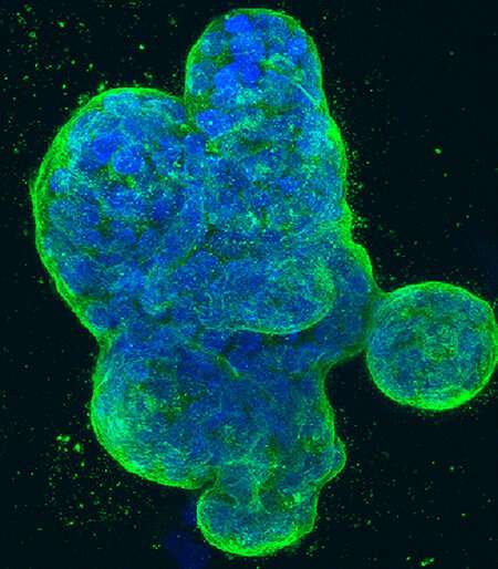 A new way to target cancers using 'synthetic lethality'