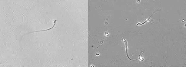 A novel sperm selection technology to increase success rates of in vitro fertilization