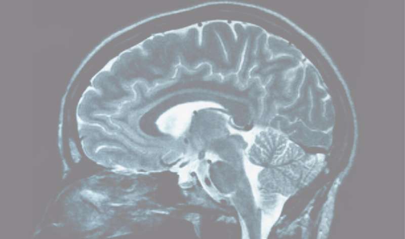 Are bigger brains better?