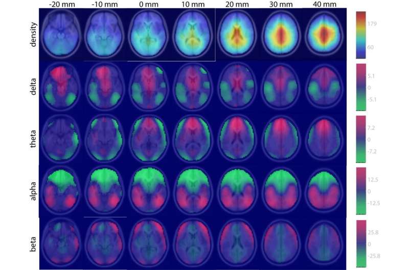 Army develops big data approach to neuroscience