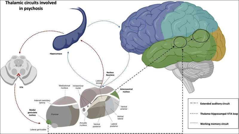 Auditory hallucinations rooted in aberrant brain connectivity