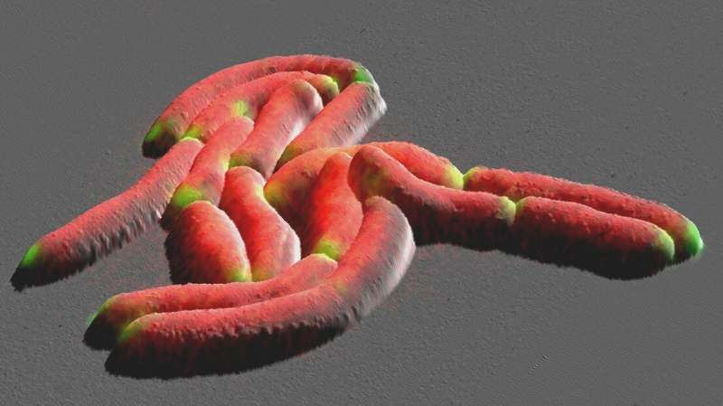 Bacteria under the microscope: a new growth model for tuberculosis
