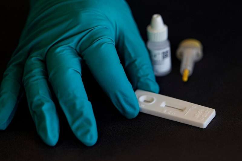 Belgian biotech company ZenTech has started producing coronavirus antibody tests