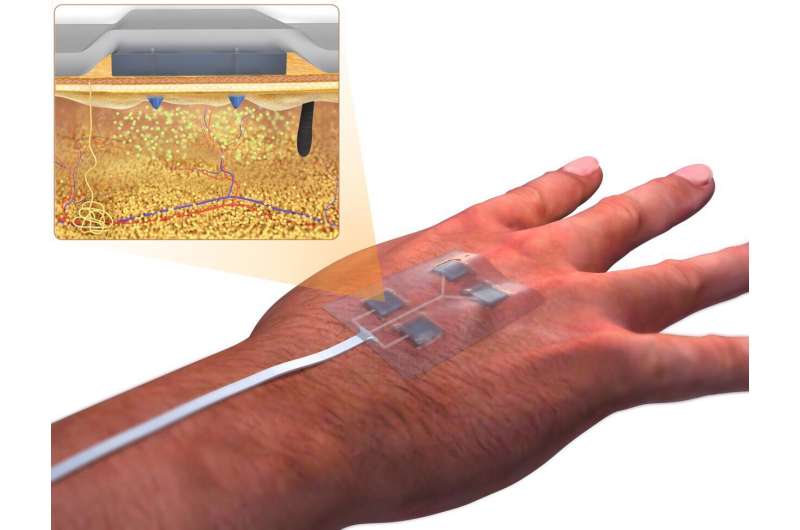 Biomedical engineers create 'smart' bandages to heal chronic wounds