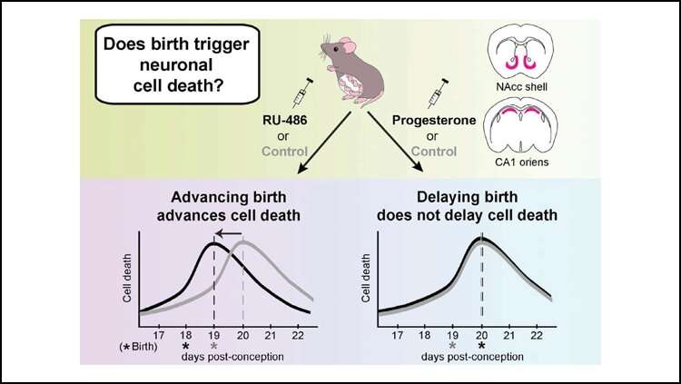 Birth timing may affect brain development