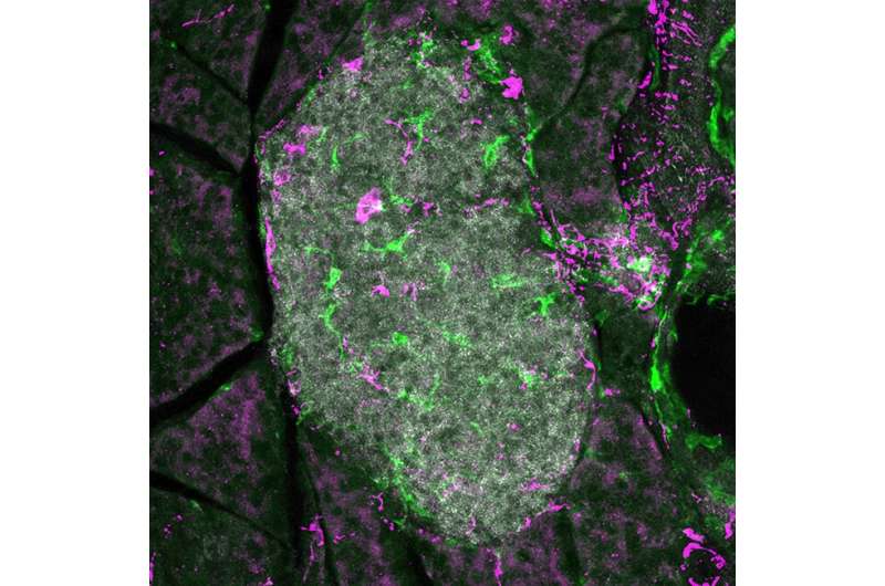 Blocking nerve signals to the pancreas halts type 1 diabetes onset in mice