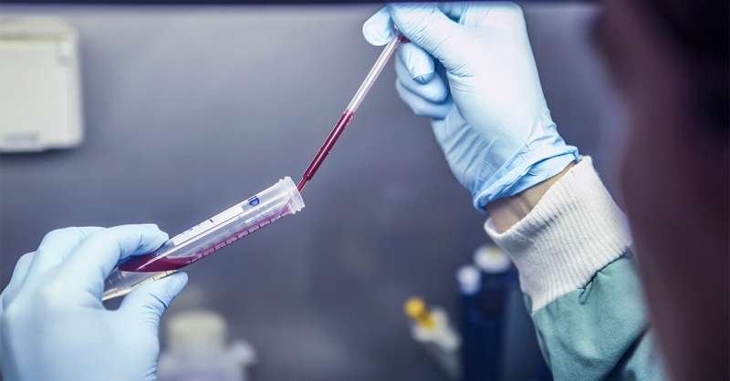 血液测试一种用于控制感染的潜在新工具