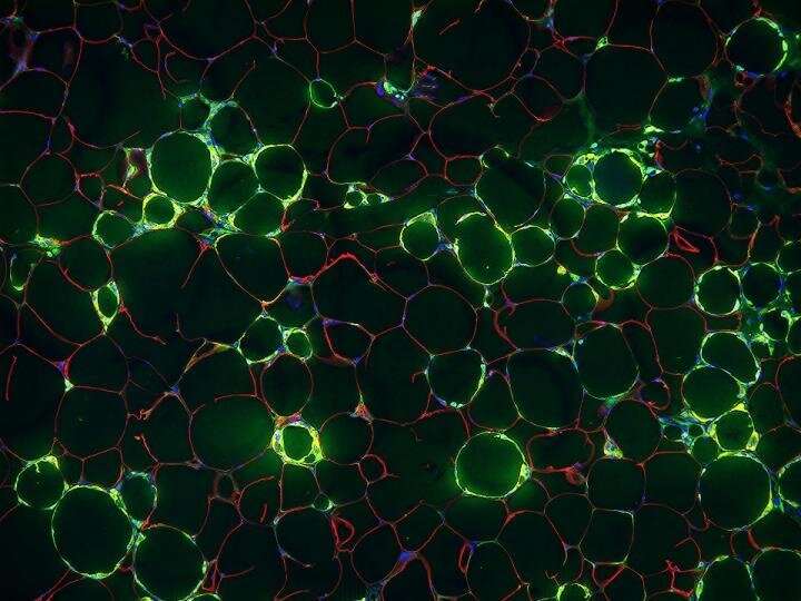 Blood vessel cells implicated in chronic inflammation of obesity