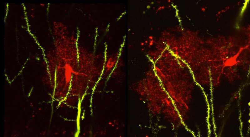 Brain protein linked to seizures, abnormal social behaviors