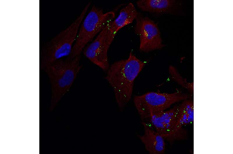 Brain's immune cells promising cellular target for therapeutics