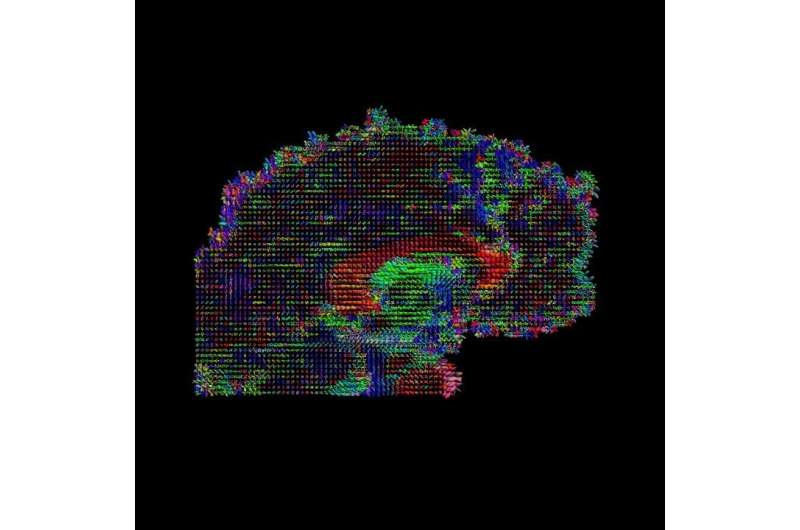 Brain thickness and connectivity, not just location, correlate with behavior