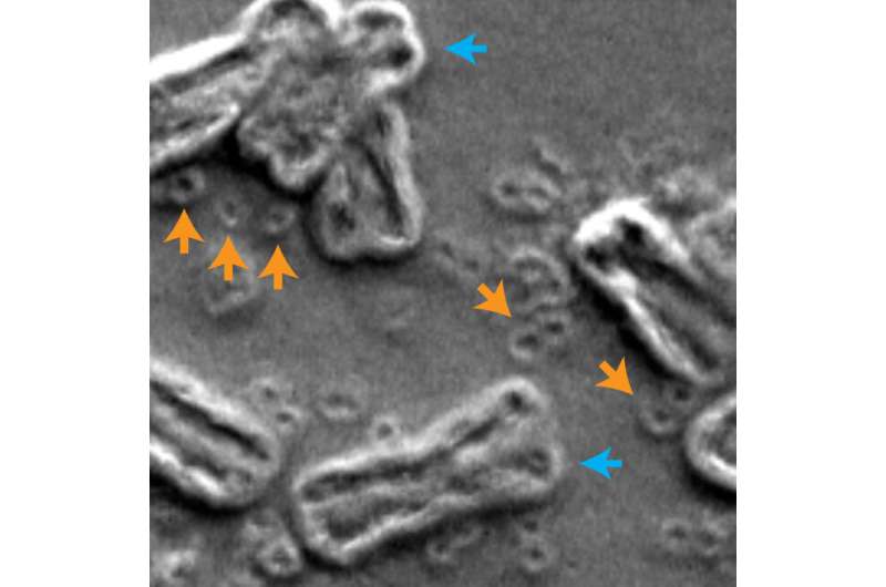 Breaking bad: how shattered chromosomes make cancer cells drug-resistant