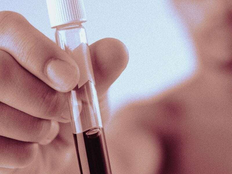 Bundled rapid HIV/Hep C testing may improve infection awareness