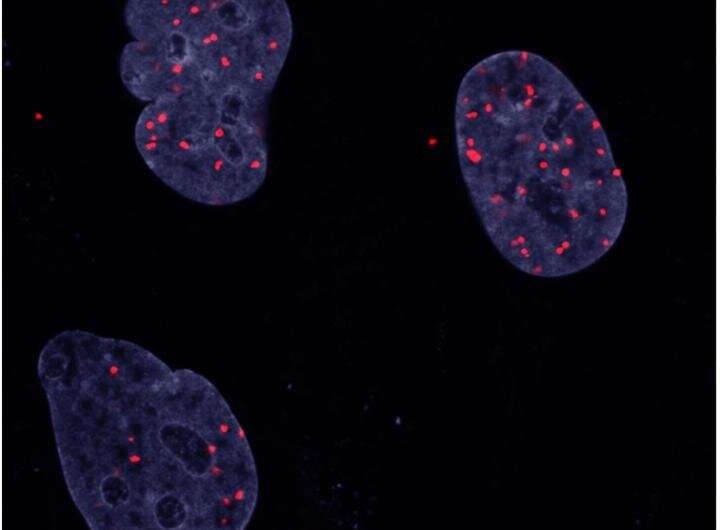 Cancer cells' growth amid crowding reveals nuanced role for known oncogene