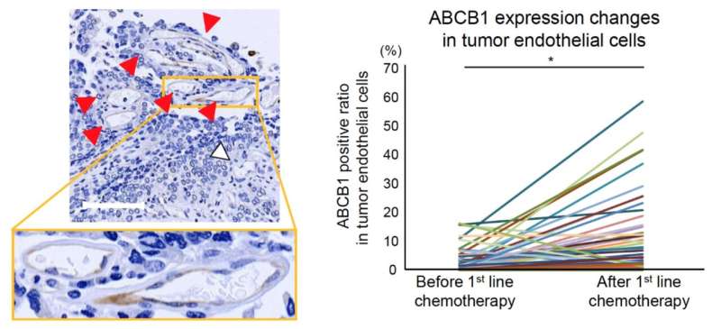 Cancer cells make blood vessels drug resistant during chemotherapy