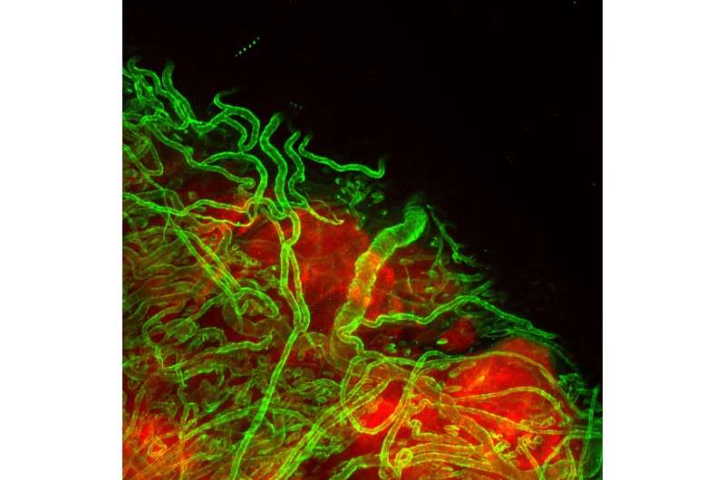 Cancer cells take over blood vessels to spread