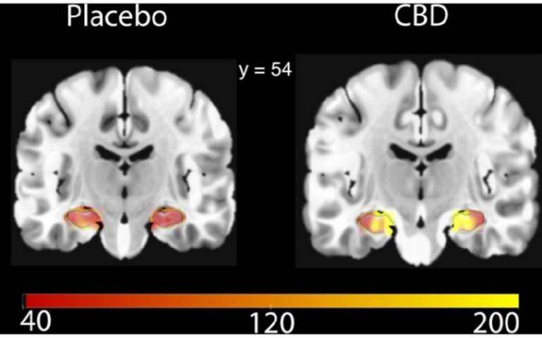 Cannabidiol improves blood flow to brain’s hippocampus