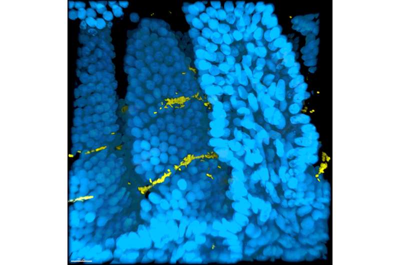 Cholera studies reveal mechanisms of biofilm formation and hyperinfectivity