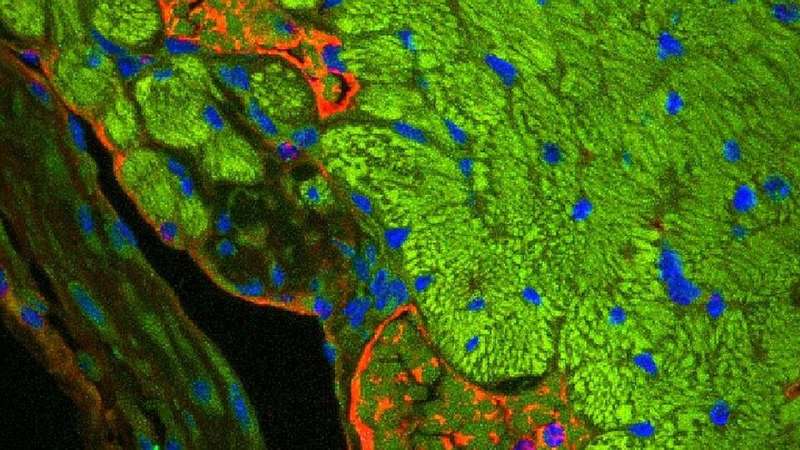 Cleaning up cellular trash helps hearts recover after heart attacks