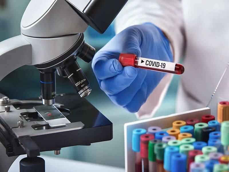 Clinical performance of SARS-COV-2 antibody tests varies