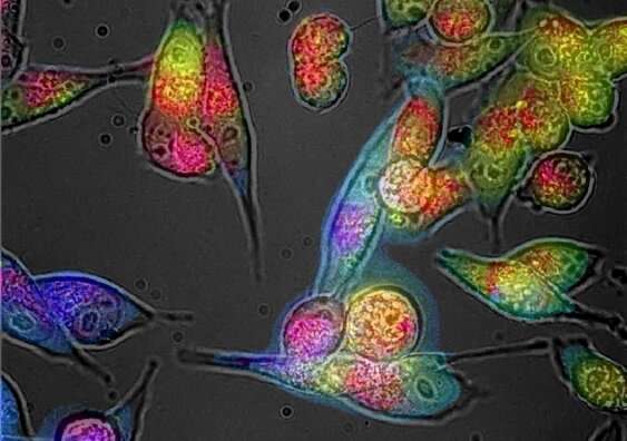 Colour of cells a 'thermometer' for molecular imbalance, study finds