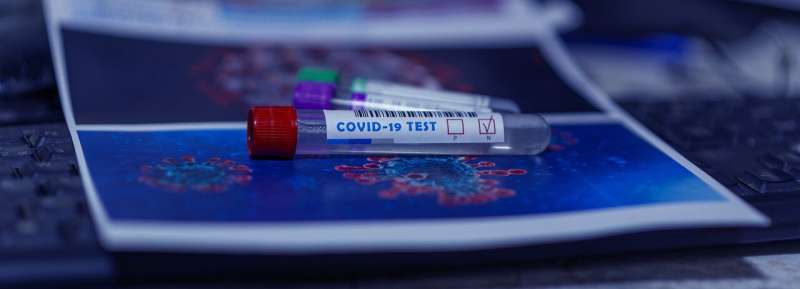 Comparison of coronavirus antibody tests revealed too optimistic claims