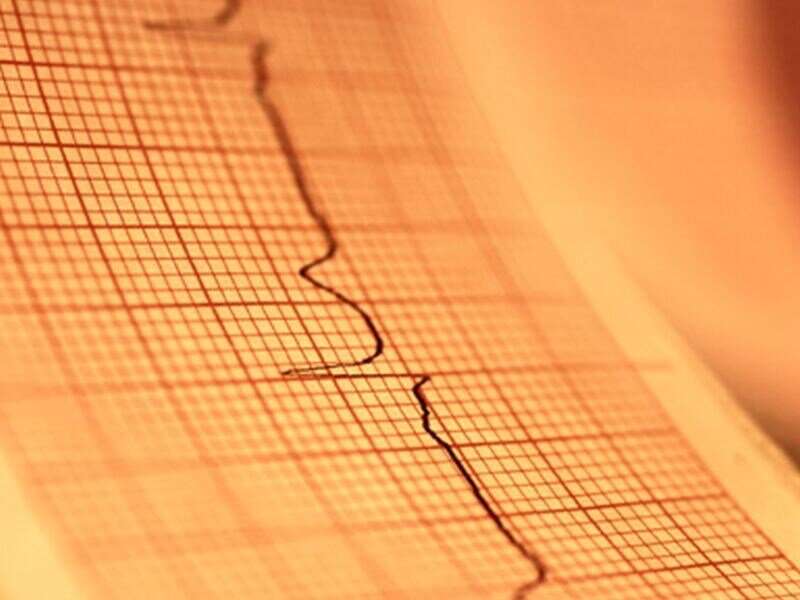 Deaths from atrial fibrillation declined from 1972 to 2015