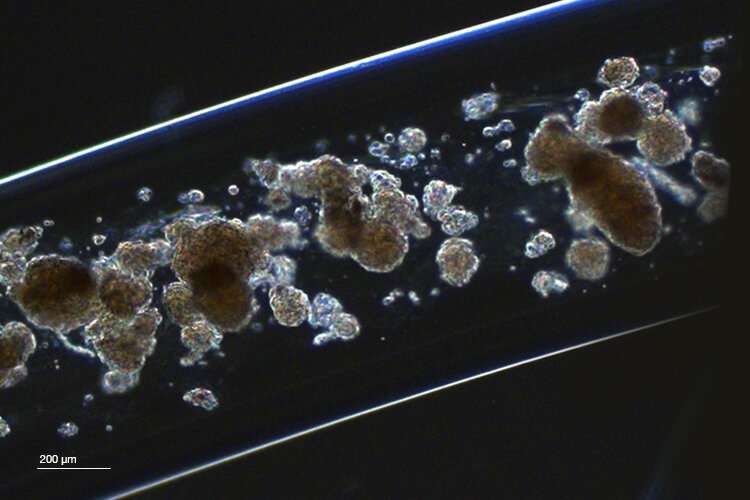 糖尿病小鼠使用可回收的毫米厚细胞负载水凝胶纤维改善