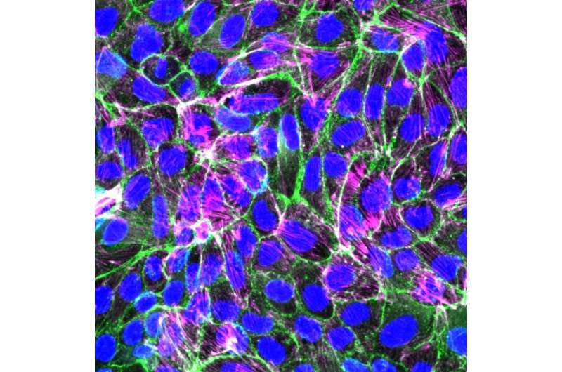 Discovery sheds new light on how cells move