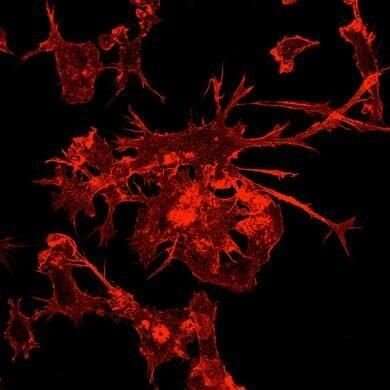 Diseased cell fragments burst from pockets in immune cells to activate response