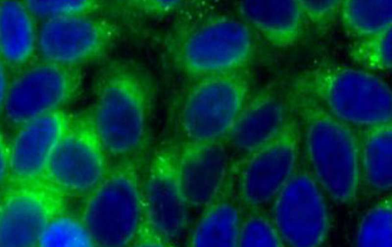 Double detection of cell changes could diagnose disease earlier