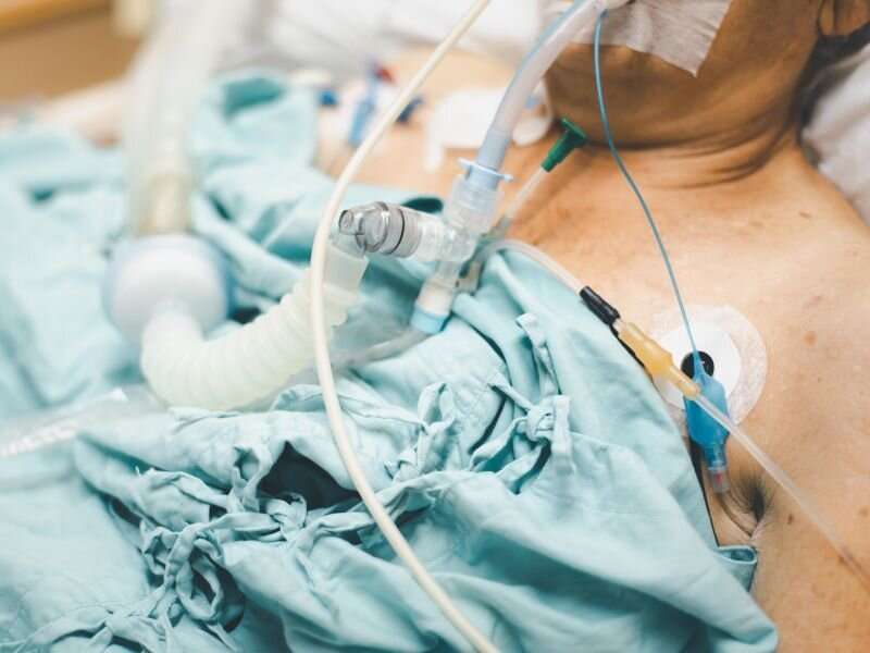 Early tracheostomy may be considered in severe COVID-19