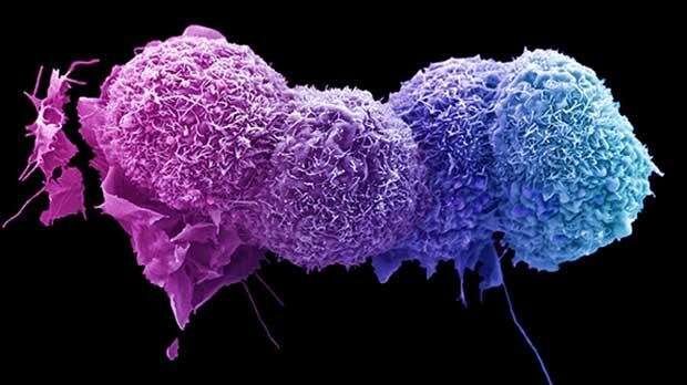 Evolution, sex and TRACERx: how cancer’s ‘spare tyre’ helps it survive  
